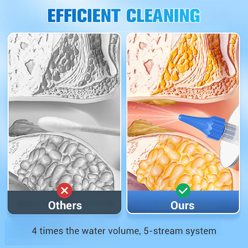 👂 50% RABATT! 💧 Ohrenschmalz-Entfernungsset (E20/W10) – Sicher & Sanft, Austauschbare Aufsätze für Schmerzlose Ohrenreinigung 🩺