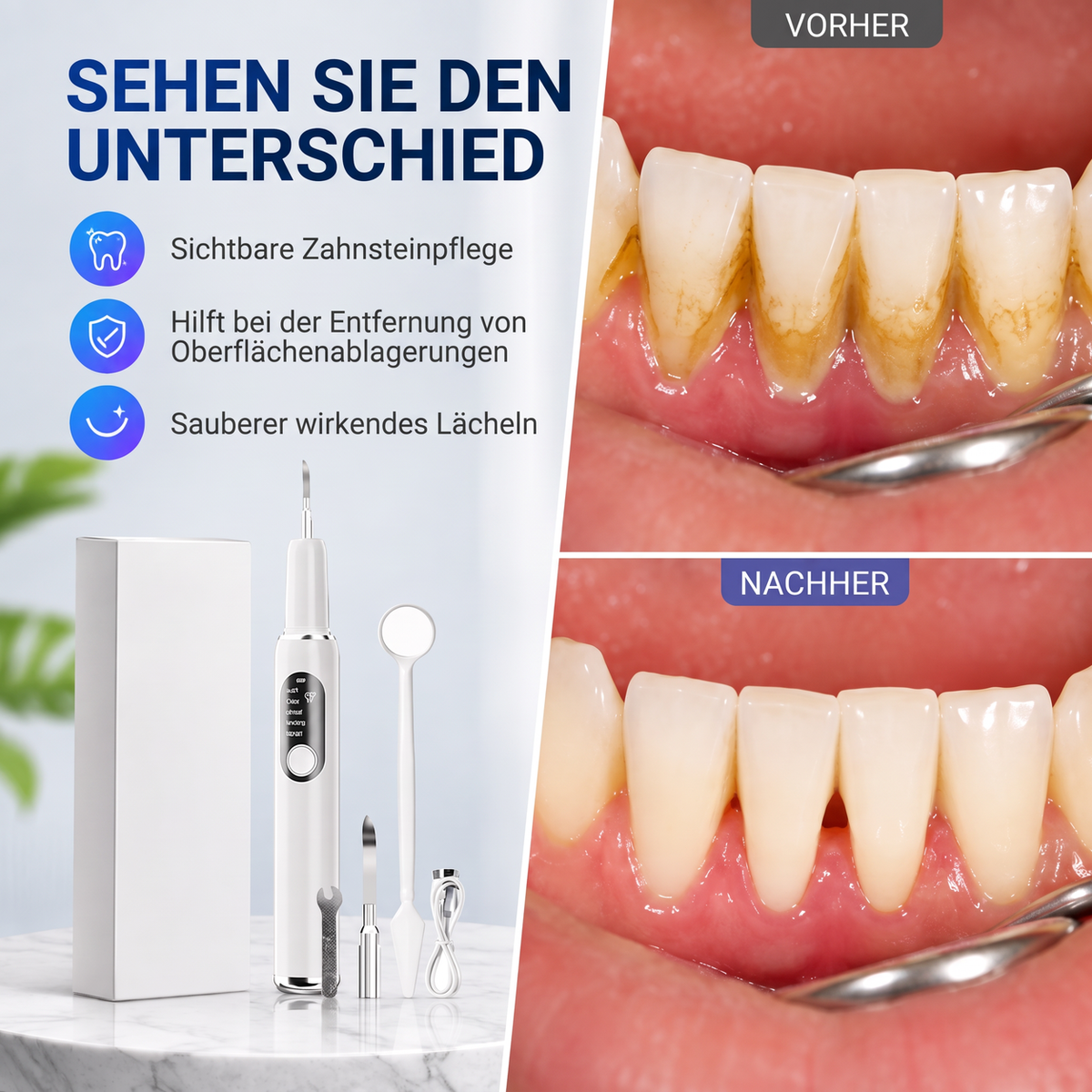 Tragbares Ultraschall-Zahnreinigungs- und Zahnsteinentfernungs-Set